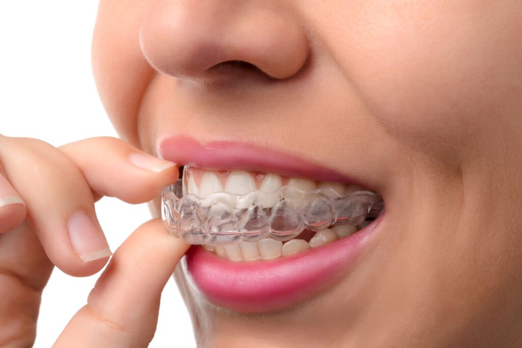 invisalign-Dental Center Oris